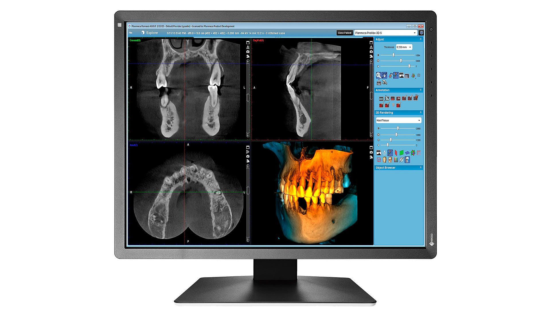 EIZO RadiForce MX216-SB LED display